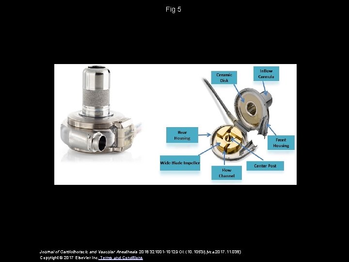 Fig 5 Journal of Cardiothoracic and Vascular Anesthesia 2018 321001 -1012 DOI: (10. 1053/j.