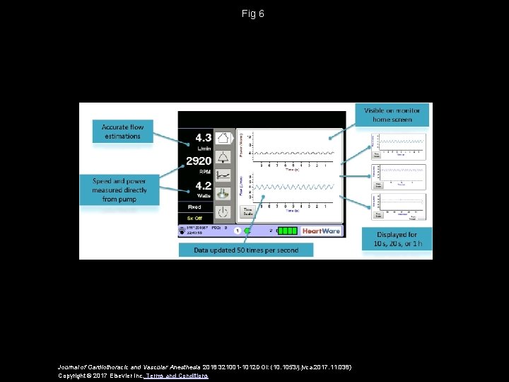 Fig 6 Journal of Cardiothoracic and Vascular Anesthesia 2018 321001 -1012 DOI: (10. 1053/j. Fig 6 Journal of Cardiothoracic and Vascular Anesthesia 2018 321001 -1012 DOI: (10. 1053/j.