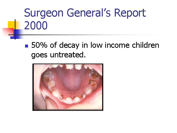 Surgeon General’s Report 2000 n 50% of decay in low income children goes untreated.