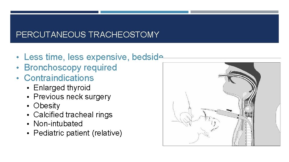 PERCUTANEOUS TRACHEOSTOMY • Less time, less expensive, bedside • Bronchoscopy required • Contraindications •