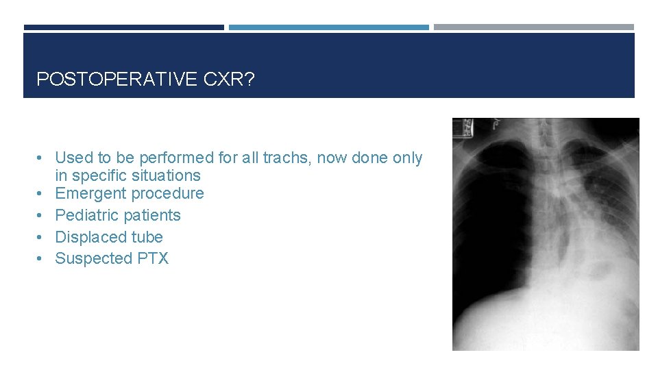 POSTOPERATIVE CXR? • Used to be performed for all trachs, now done only •