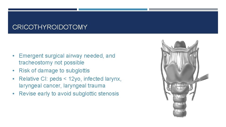 CRICOTHYROIDOTOMY • Emergent surgical airway needed, and tracheostomy not possible • Risk of damage