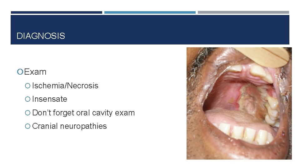 DIAGNOSIS Exam Ischemia/Necrosis Insensate Don’t forget oral cavity exam Cranial neuropathies 