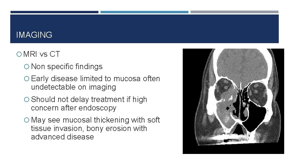 IMAGING MRI vs CT Non specific findings Early disease limited to mucosa often undetectable