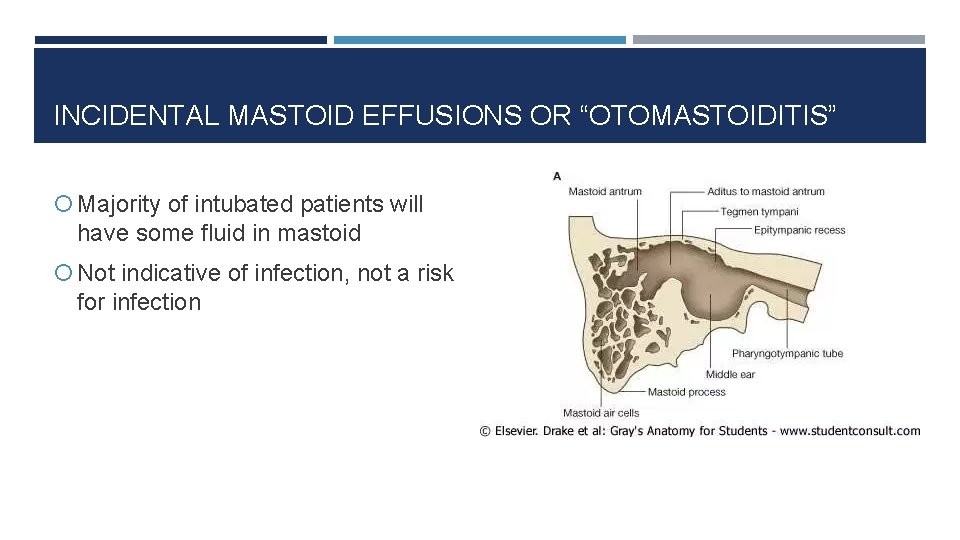 INCIDENTAL MASTOID EFFUSIONS OR “OTOMASTOIDITIS” Majority of intubated patients will have some fluid in