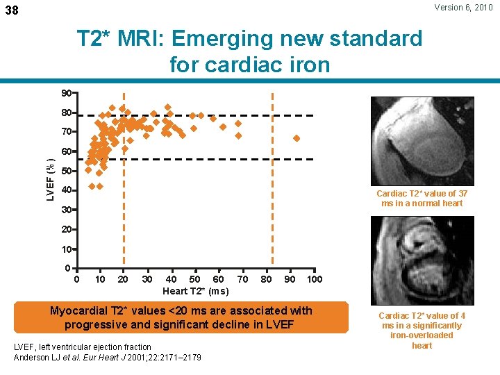 Version 6, 2010 38 T 2* MRI: Emerging new standard for cardiac iron 90