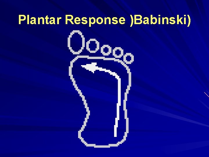 Plantar Response )Babinski) Plantar Response )Babinski)