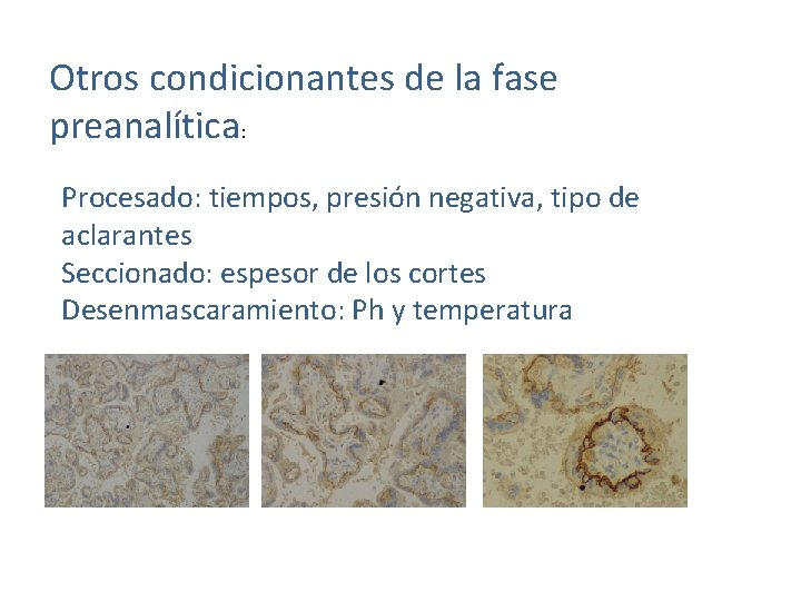 Otros condicionantes de la fase preanalítica: Procesado: tiempos, presión negativa, tipo de aclarantes Seccionado: