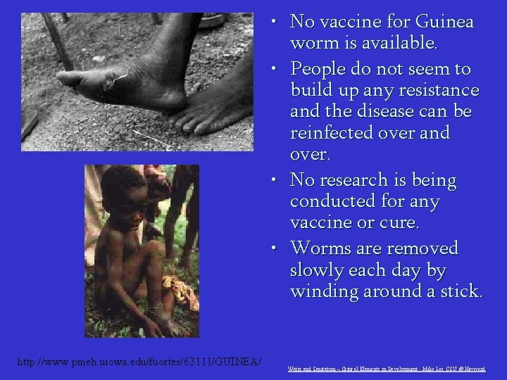  • No vaccine for Guinea worm is available. • People do not seem