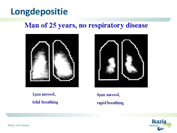 Longdepositie Man of 25 years, no respiratory disease 1µm aerosol, 6µm aerosol, tidal breathing