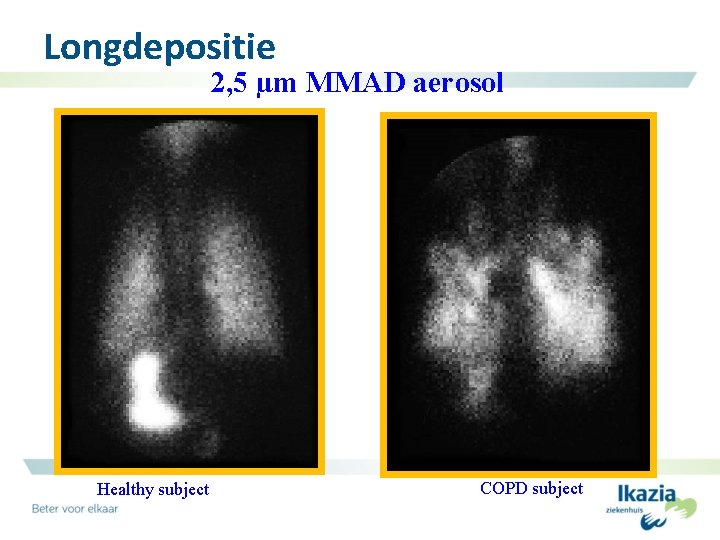 Longdepositie 2, 5 µm MMAD aerosol Healthy subject COPD subject 