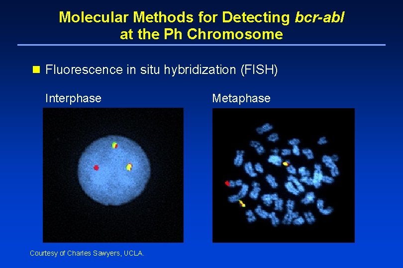 Molecular Methods for Detecting bcr-abl at the Ph Chromosome n Fluorescence in situ hybridization