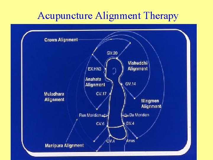 Acupuncture Alignment Therapy 