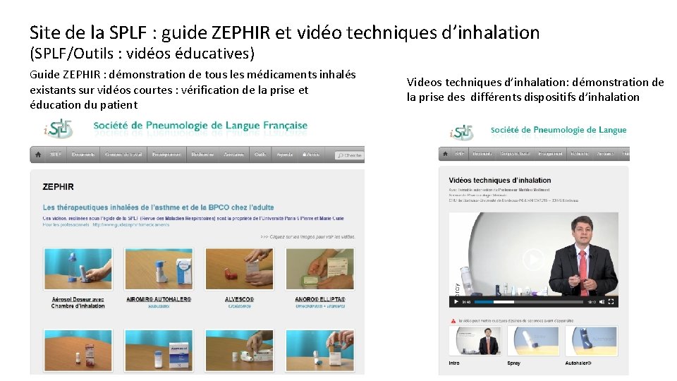 Site de la SPLF : guide ZEPHIR et vidéo techniques d’inhalation (SPLF/Outils : vidéos