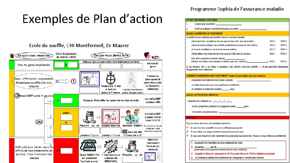 Exemples de Plan d’action Ecole du souffle, CHI Montfermeil, Dr Maurer Programme Sophia de