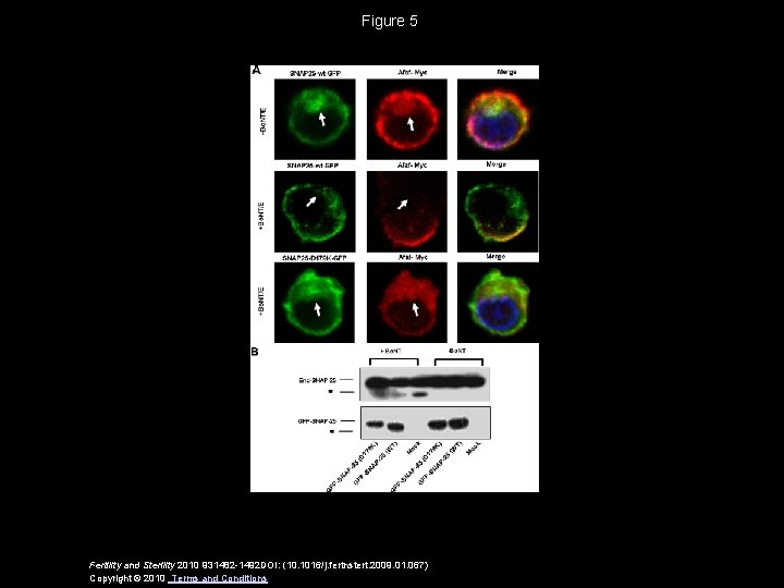 Figure 5 Fertility and Sterility 2010 931482 -1492 DOI: (10. 1016/j. fertnstert. 2009. 01.