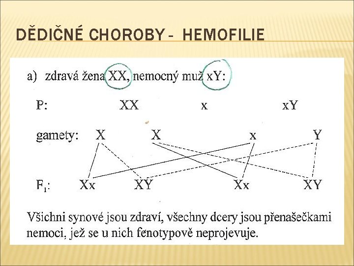 DĚDIČNÉ CHOROBY - HEMOFILIE 