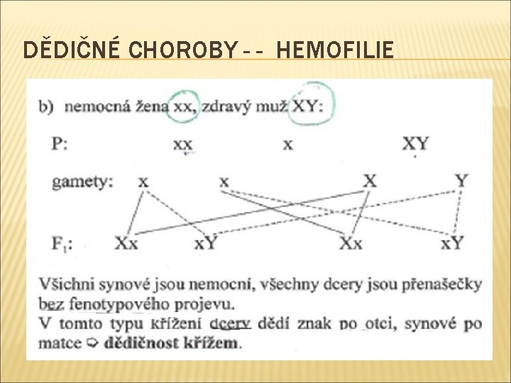 DĚDIČNÉ CHOROBY - - HEMOFILIE 