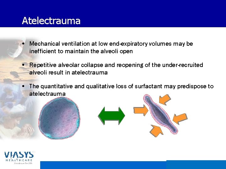 Atelectrauma • Mechanical ventilation at low end-expiratory volumes may be inefficient to maintain the