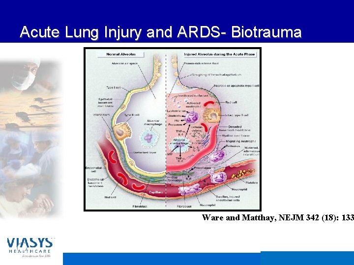 Acute Lung Injury and ARDS- Biotrauma Ware and Matthay, NEJM 342 (18): 133 VIASYS