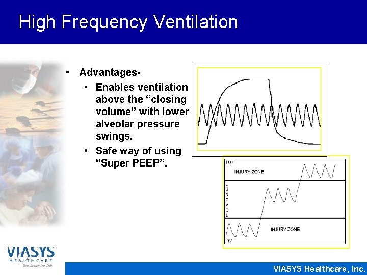 High Frequency Ventilation • Advantages • Enables ventilation above the “closing volume” with lower