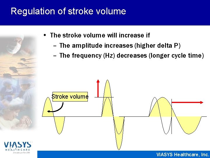 Regulation of stroke volume • The stroke volume will increase if – The amplitude