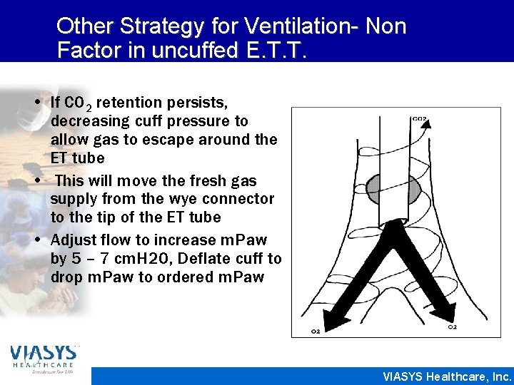 Other Strategy for Ventilation- Non Factor in uncuffed E. T. T. • If CO