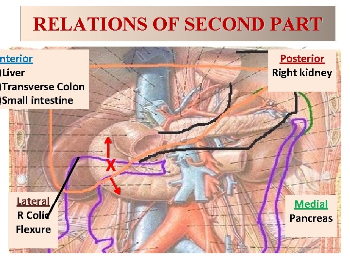 RELATIONS OF SECOND PART nterior )Liver )Transverse Colon )Small intestine Posterior Right kidney X