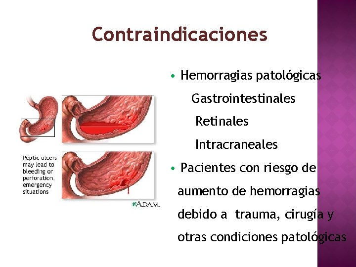 Contraindicaciones • Hemorragias patológicas Gastrointestinales Retinales Intracraneales • Pacientes con riesgo de aumento de