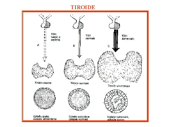 TIROIDE 