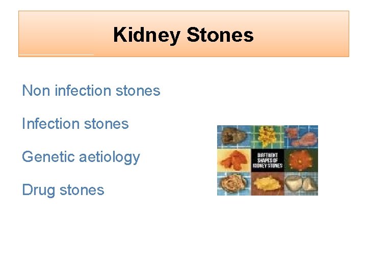 Kidney Stones Non infection stones Infection stones Genetic aetiology Drug stones 