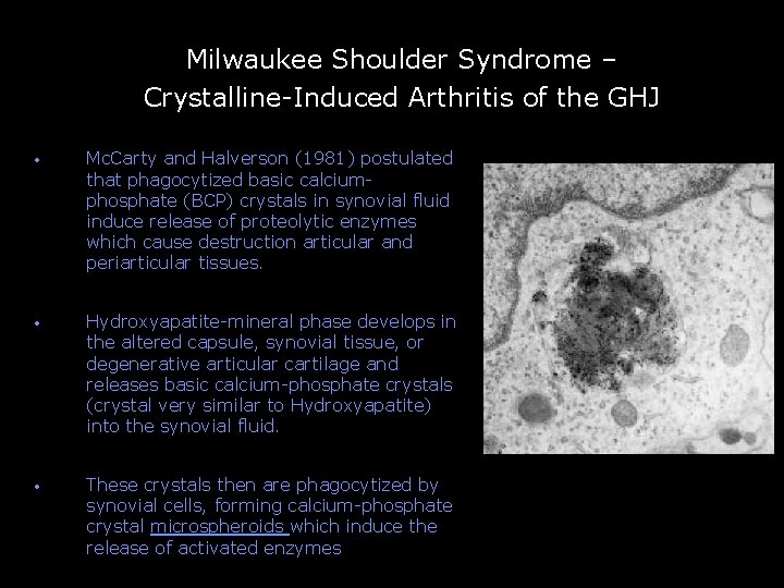 Milwaukee Shoulder Syndrome – Crystalline-Induced Arthritis of the GHJ -- • Mc. Carty and