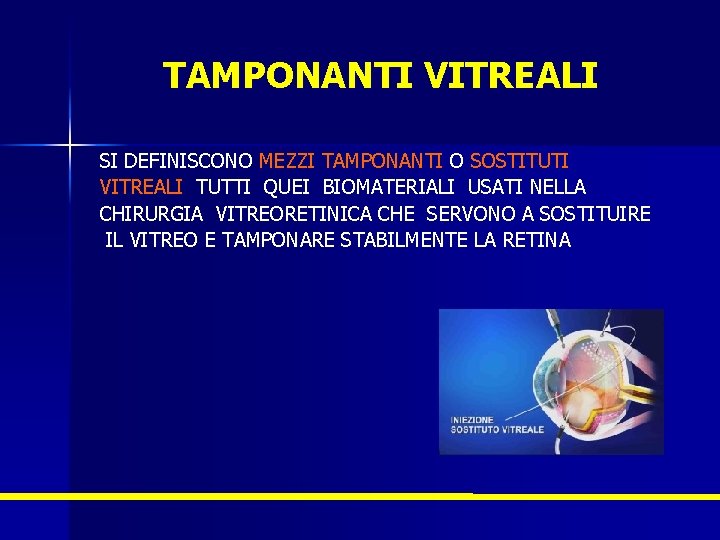 TAMPONANTI VITREALI SI DEFINISCONO MEZZI TAMPONANTI O SOSTITUTI VITREALI TUTTI QUEI BIOMATERIALI USATI NELLA