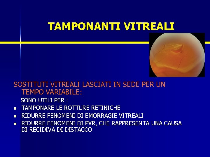 TAMPONANTI VITREALI SOSTITUTI VITREALI LASCIATI IN SEDE PER UN TEMPO VARIABILE: n n n