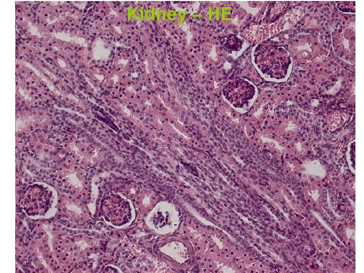 Kidney – HE Kidney – HE