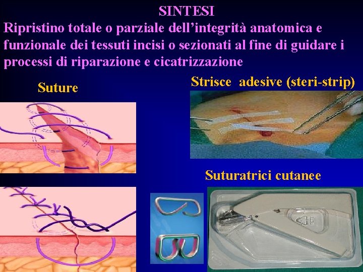 SINTESI Ripristino totale o parziale dell’integrità anatomica e funzionale dei tessuti incisi o sezionati