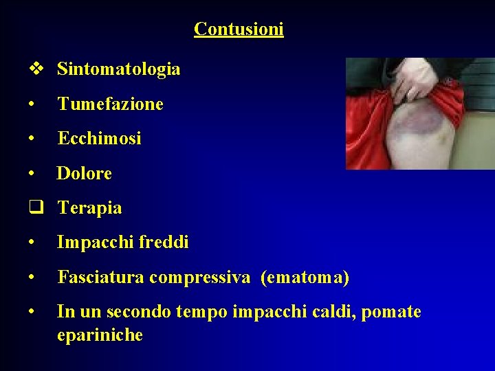 Contusioni v Sintomatologia • Tumefazione • Ecchimosi • Dolore q Terapia • Impacchi freddi