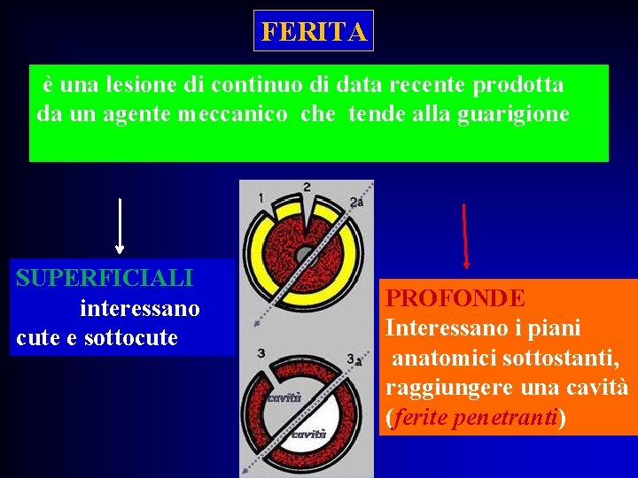 FERITA è una lesione di continuo di data recente prodotta da un agente meccanico