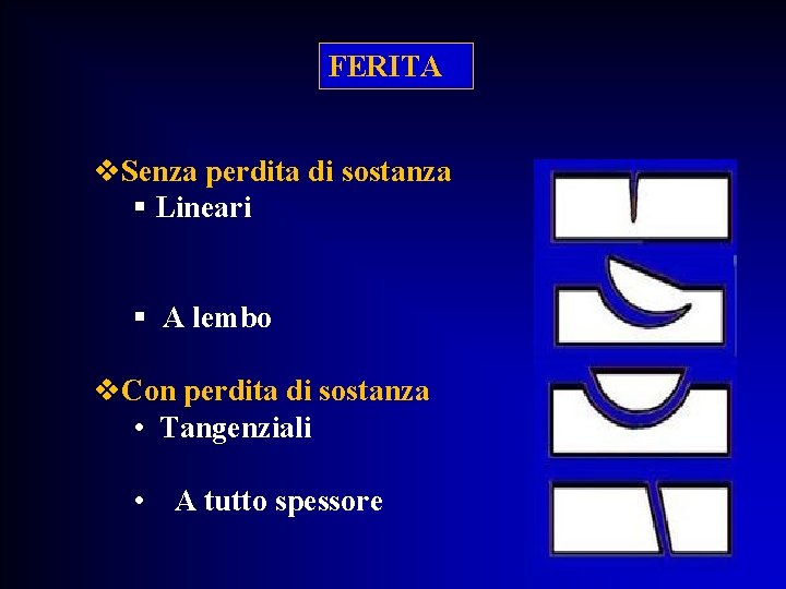 FERITA v. Senza perdita di sostanza § Lineari § A lembo v. Con perdita