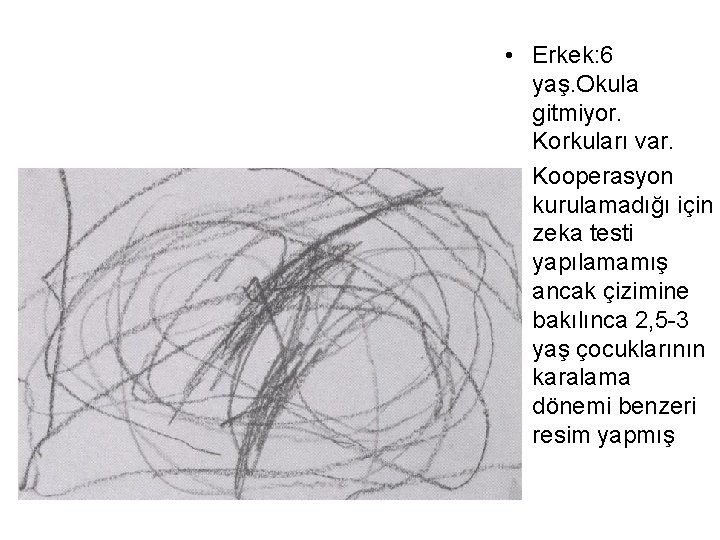  • Erkek: 6 yaş. Okula gitmiyor. Korkuları var. • Kooperasyon kurulamadığı için zeka