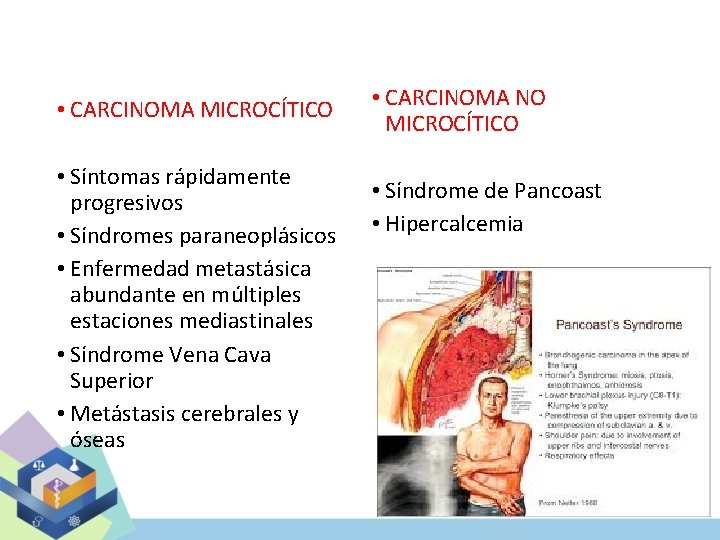  • CARCINOMA MICROCÍTICO • Síntomas rápidamente progresivos • Síndromes paraneoplásicos • Enfermedad metastásica