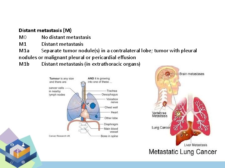 Distant metastasis (M) M 0 No distant metastasis M 1 Distant metastasis M 1