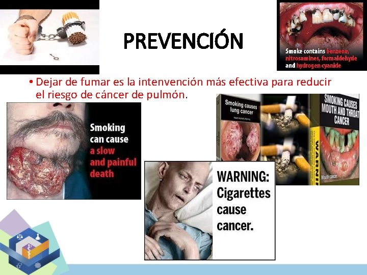 PREVENCIÓN • Dejar de fumar es la intenvención más efectiva para reducir el riesgo