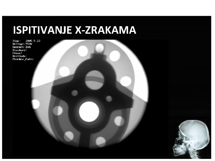 ISPITIVANJE X-ZRAKAMA 