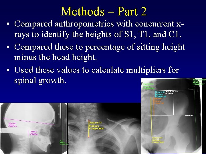 Methods – Part 2 • Compared anthropometrics with concurrent xrays to identify the heights