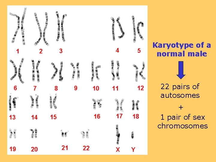 Karyotype of a normal male 22 pairs of autosomes + 1 pair of sex