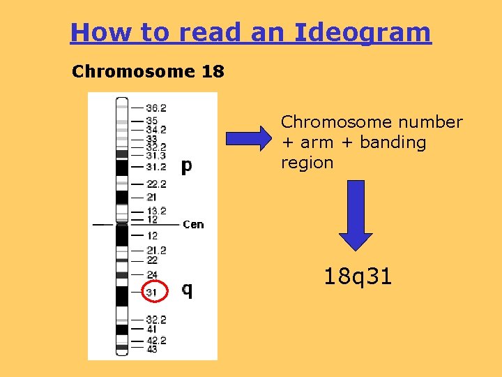 How to read an Ideogram Chromosome 18 Chromosome number + arm + banding region