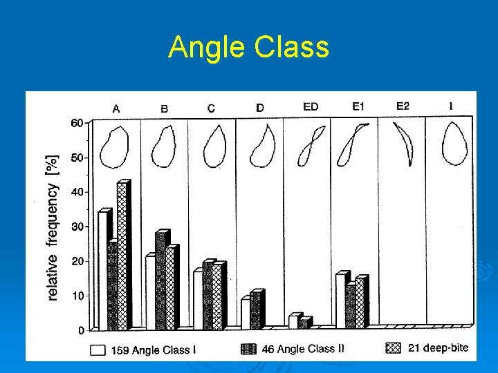 Angle Class 