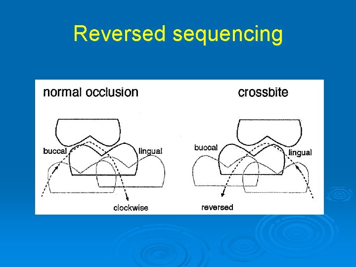 Reversed sequencing 