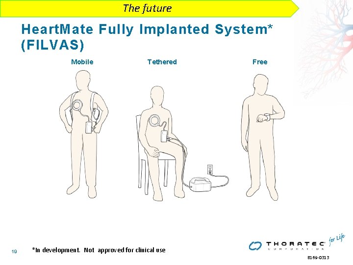 The future Heart. Mate Fully Implanted System* (FILVAS) Mobile 19 Tethered Free *In development. The future Heart. Mate Fully Implanted System* (FILVAS) Mobile 19 Tethered Free *In development.